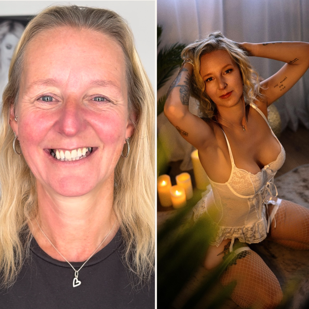 before-after-5
