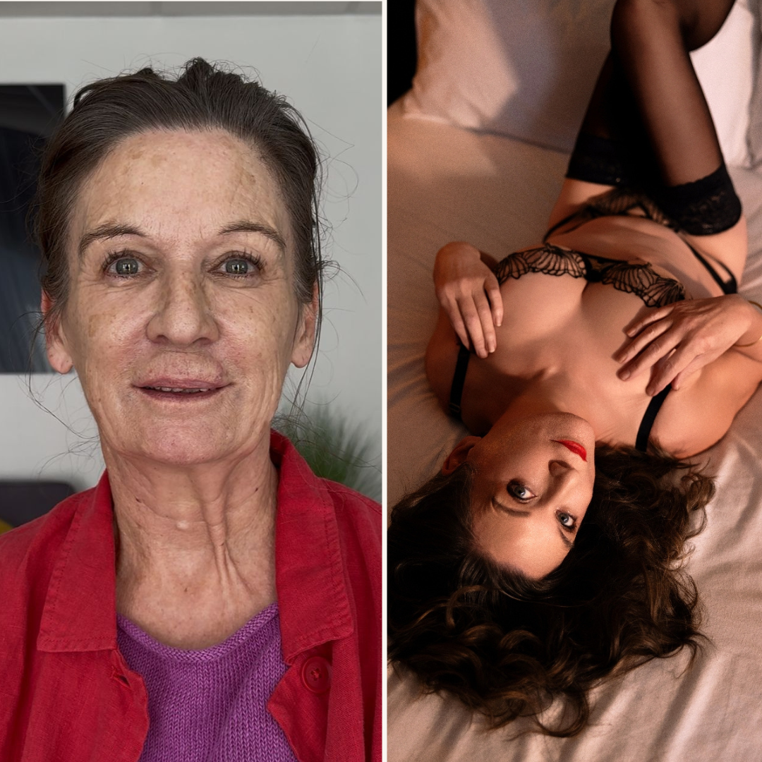 before-after-6