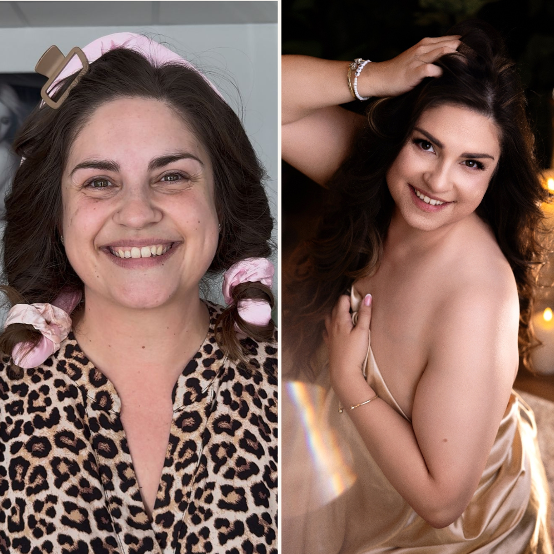 before-after-8